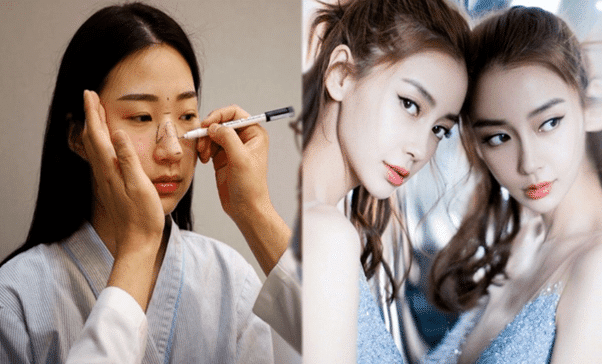 대표적인 고관여 제품인 성형 수술